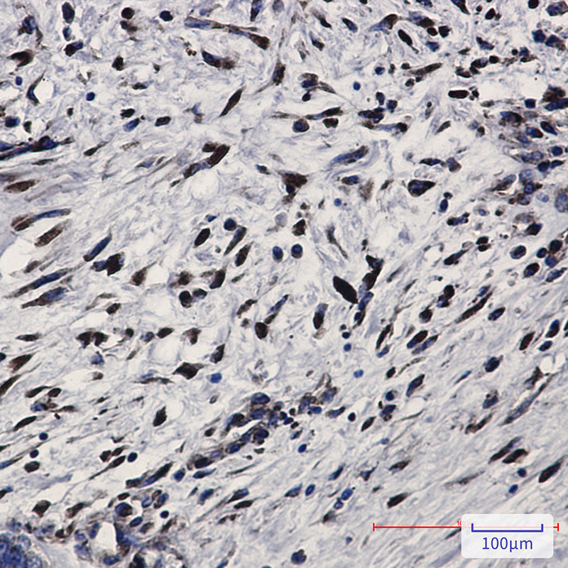 Anti-PKR Rabbit Monoclonal Antibody