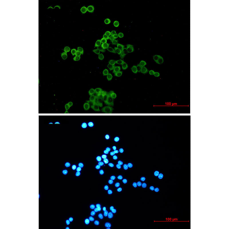 Anti-Desmocollin 3 Rabbit Monoclonal Antibody