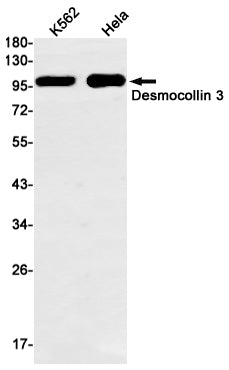 Anti-Desmocollin 3 Rabbit Monoclonal Antibody