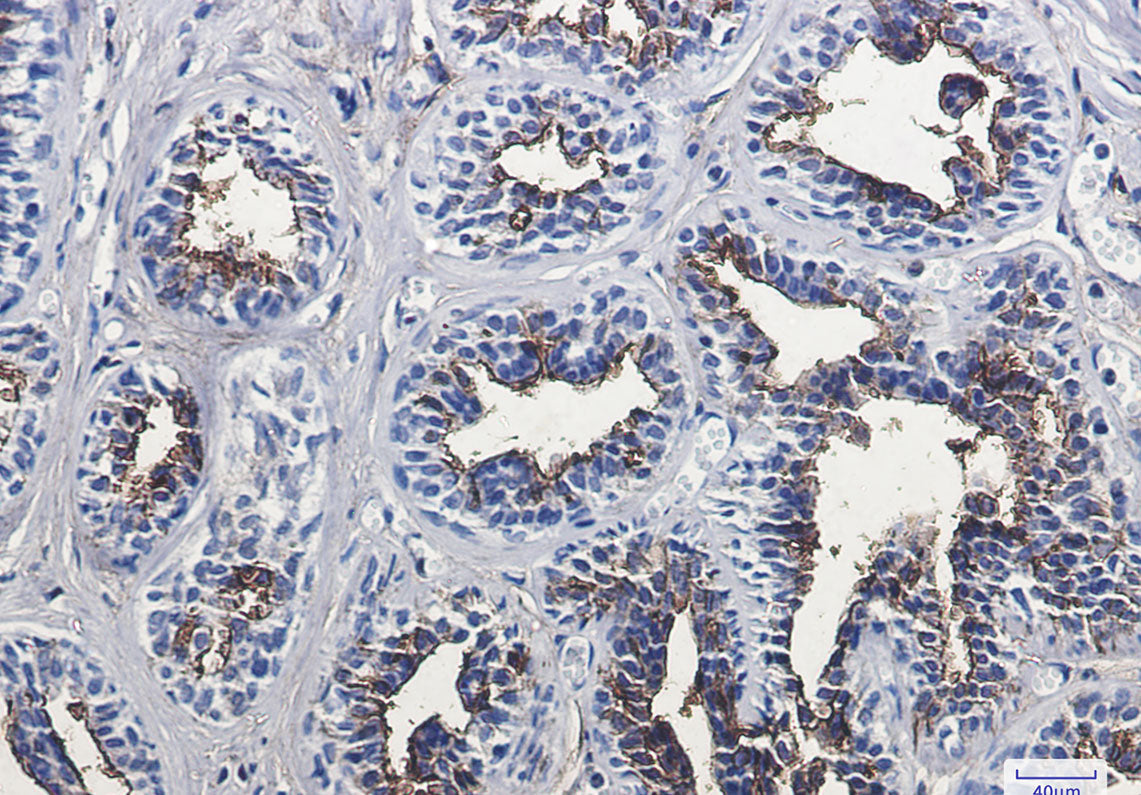 Anti-CD13 Rabbit Monoclonal Antibody
