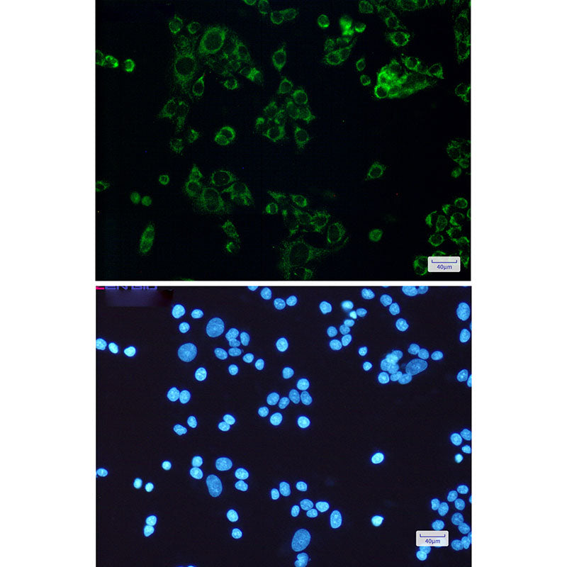 Anti-SLP2 Rabbit Monoclonal Antibody