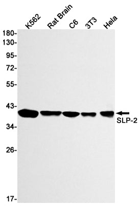 Anti-SLP2 Rabbit Monoclonal Antibody