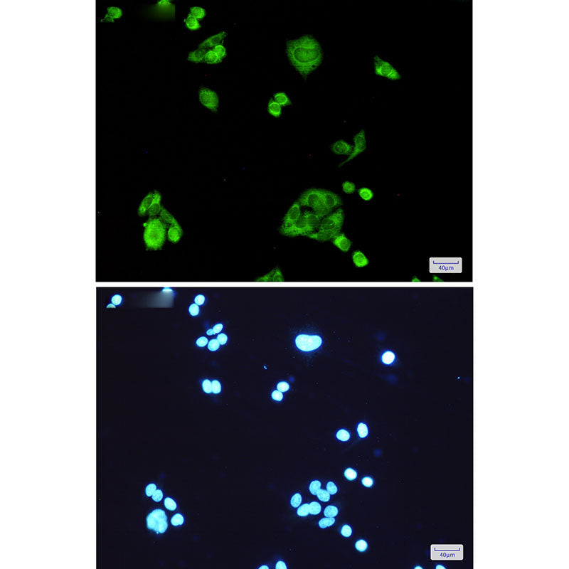 Anti-PGD Rabbit Monoclonal Antibody