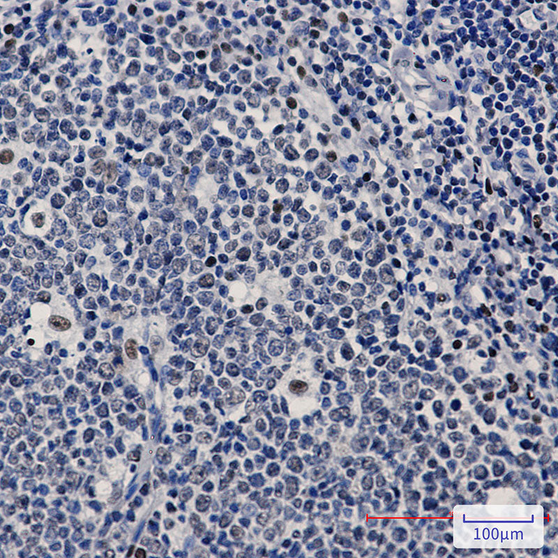 Anti-PREB Rabbit Monoclonal Antibody