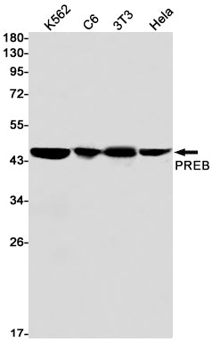 Anti-PREB Rabbit Monoclonal Antibody