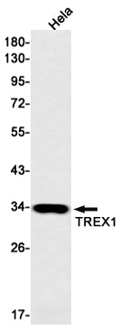 Anti-TREX1 Rabbit Monoclonal Antibody