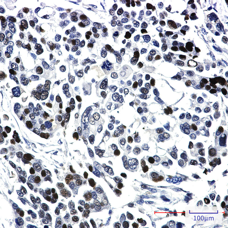 Anti-KAT13A Rabbit Monoclonal Antibody