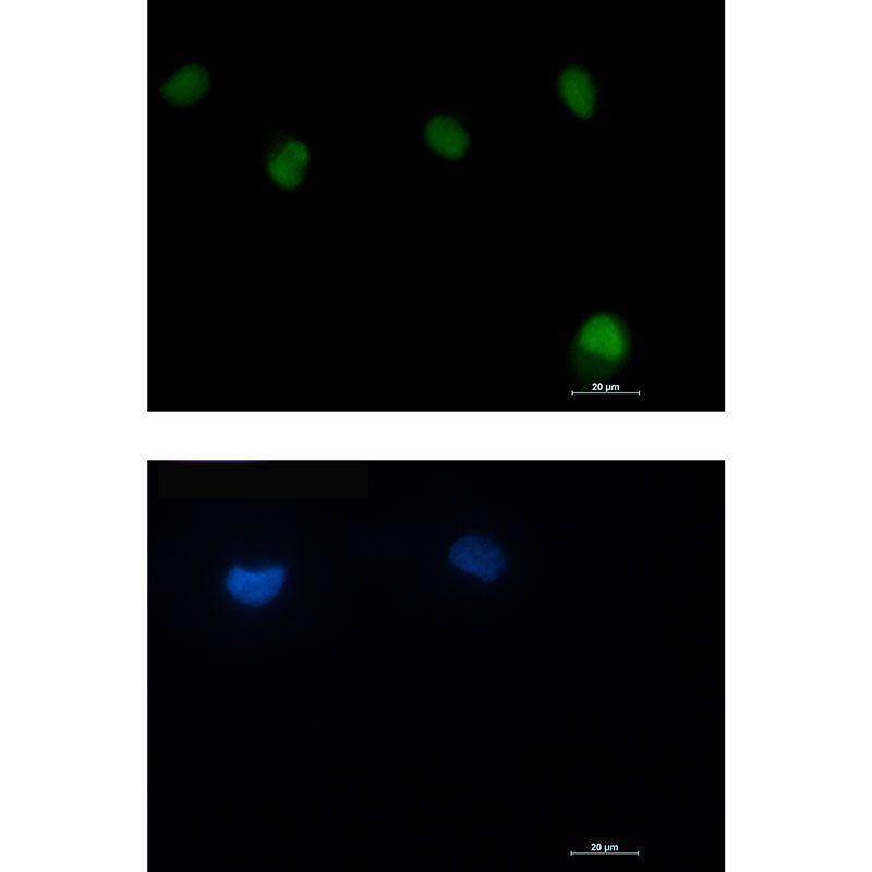 Anti-ATM Rabbit Monoclonal Antibody