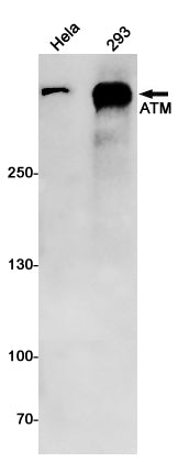 Anti-ATM Rabbit Monoclonal Antibody