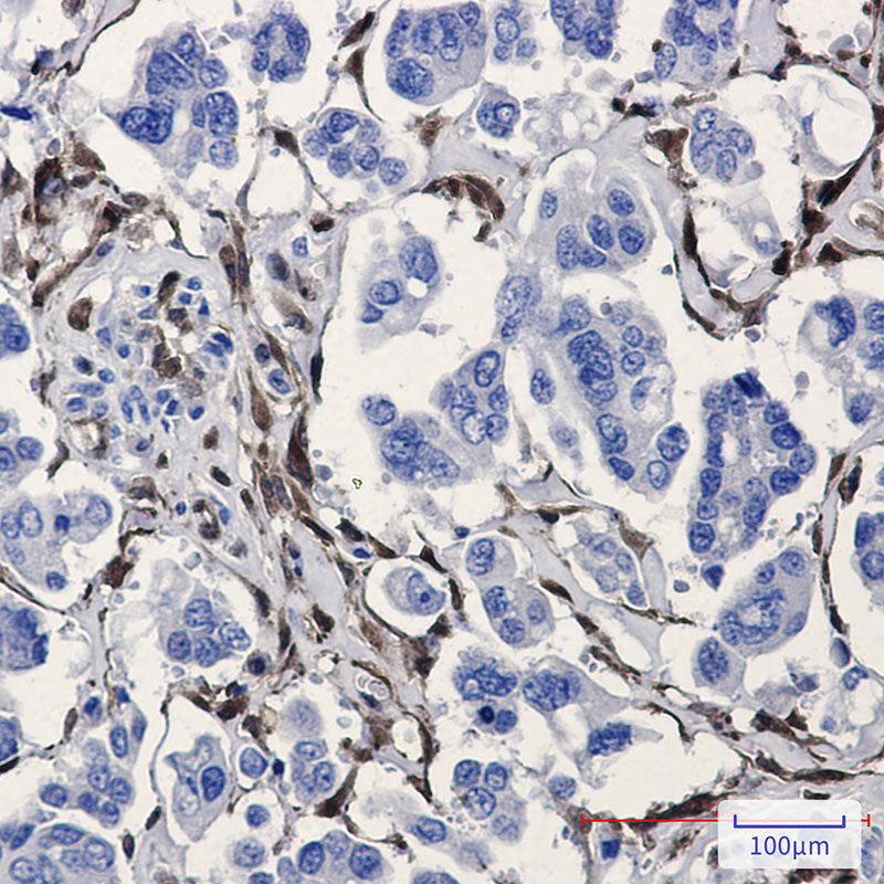 Anti-ALDH1A1 Rabbit Monoclonal Antibody