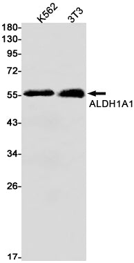 Anti-ALDH1A1 Rabbit Monoclonal Antibody