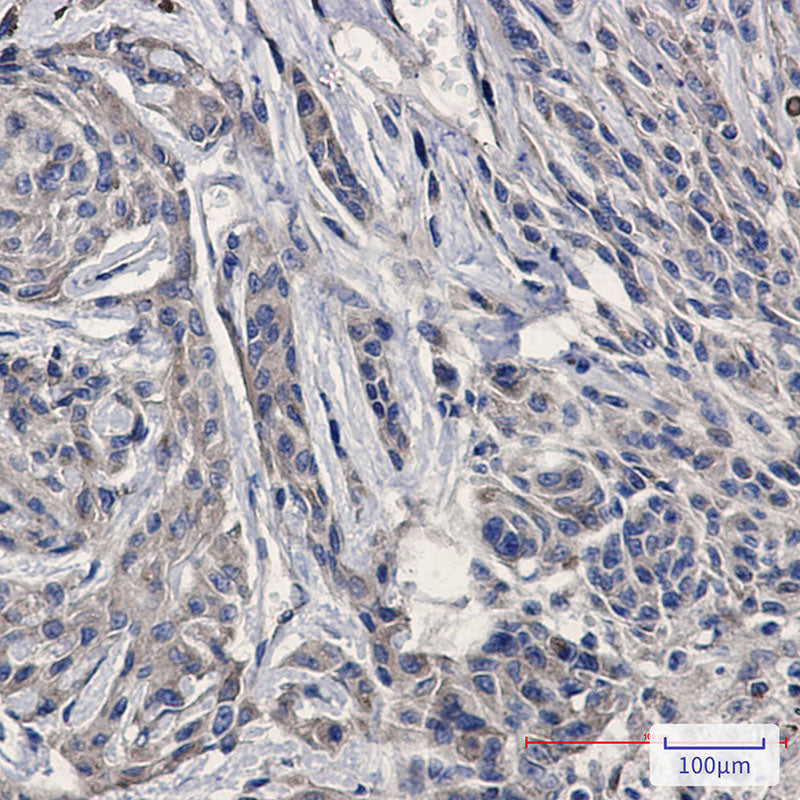 Anti-Amyloid Precursor Protein Rabbit Monoclonal Antibody