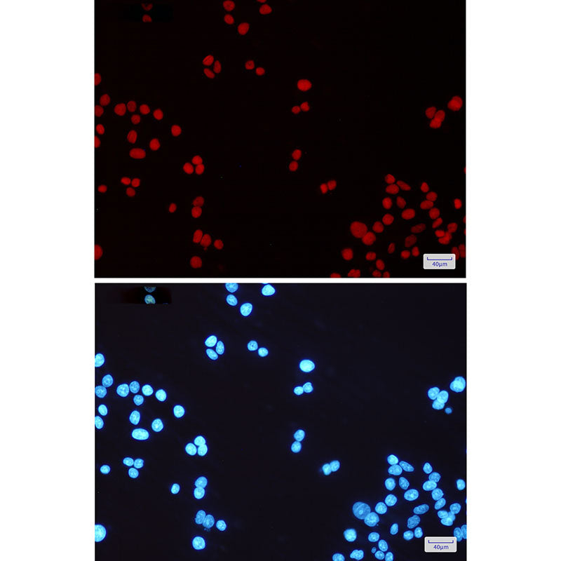 Anti-MSH6 Rabbit Monoclonal Antibody