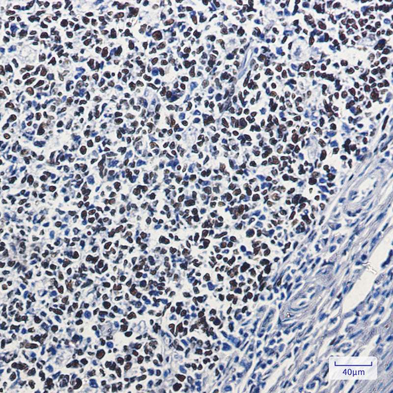 Anti-MSH6 Rabbit Monoclonal Antibody