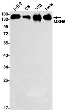 Anti-MSH6 Rabbit Monoclonal Antibody