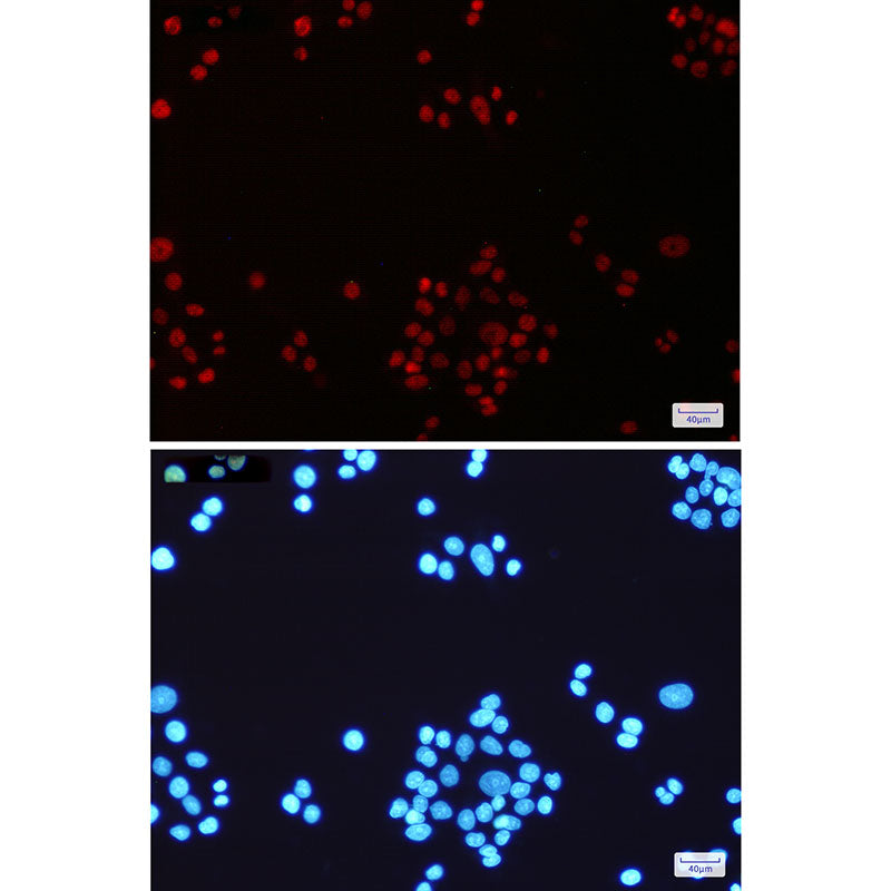 Anti-MLH1 Rabbit Monoclonal Antibody