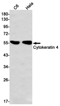 Anti-Cytokeratin 4 Rabbit Monoclonal Antibody