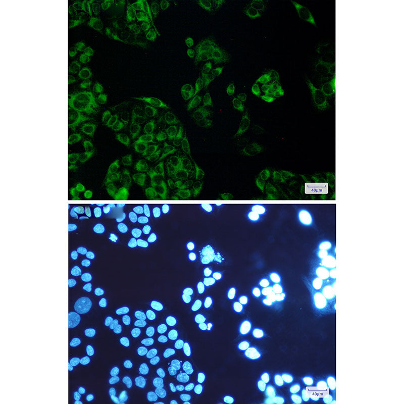 Anti-FDFT1 Rabbit Monoclonal Antibody