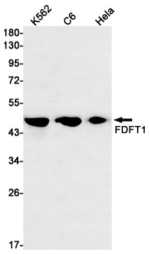 Anti-FDFT1 Rabbit Monoclonal Antibody