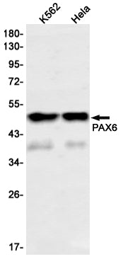 Anti-PAX6 Rabbit Monoclonal Antibody