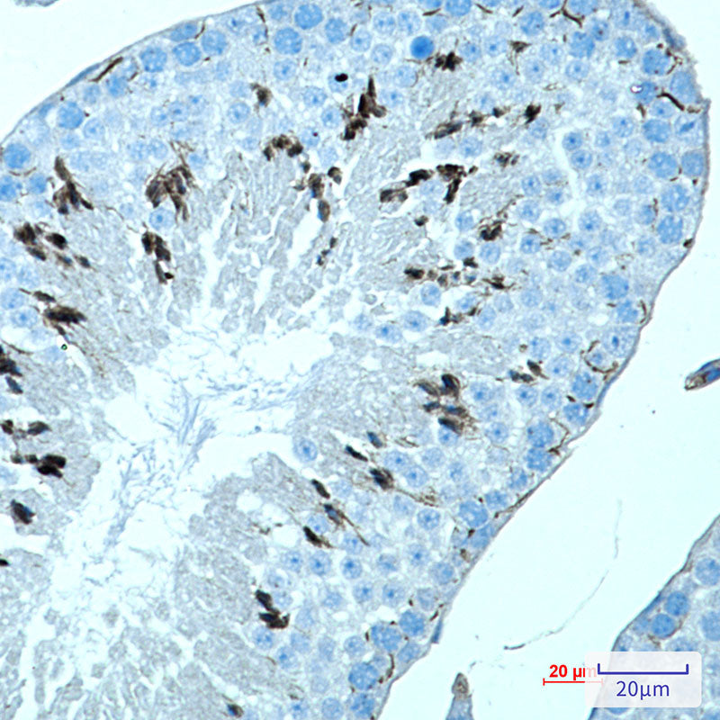 Anti-MAGEC2 Rabbit Monoclonal Antibody