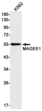 Anti-MAGEC2 Rabbit Monoclonal Antibody