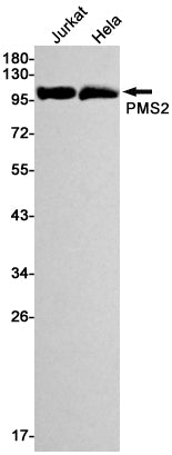 Anti-PMS2 Rabbit Monoclonal Antibody
