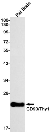 Anti-CD90 Rabbit Monoclonal Antibody