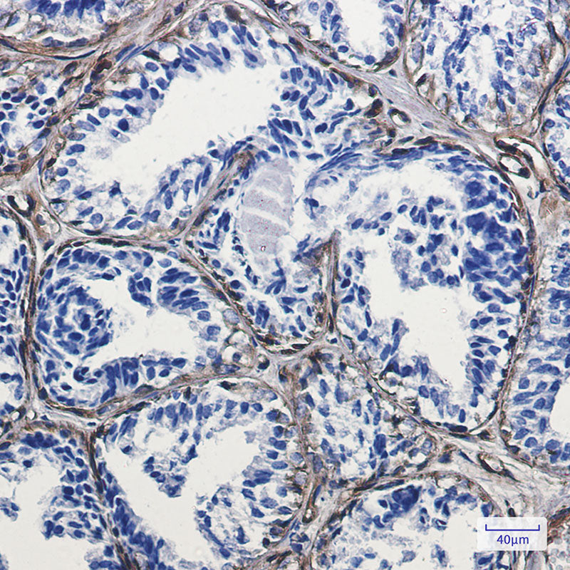 Anti-Caveolin 1 Rabbit Monoclonal Antibody