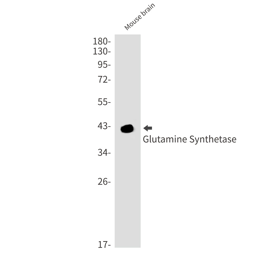 Anti-Glutamine Synthetase Rabbit Monoclonal Antibody