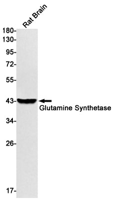 Anti-Glutamine Synthetase Rabbit Monoclonal Antibody