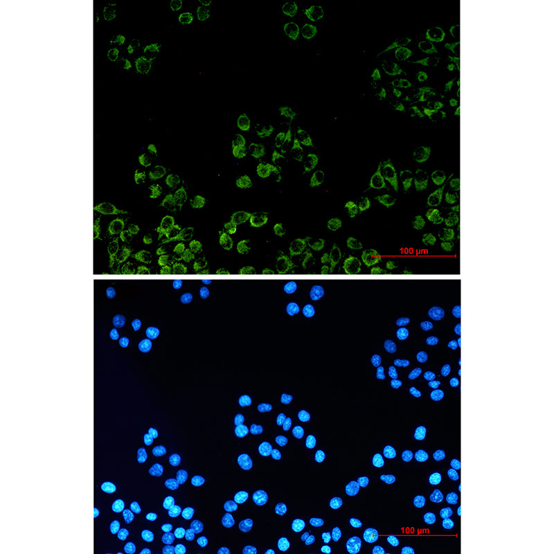 Anti-PBR Rabbit Monoclonal Antibody