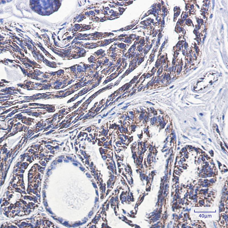 Anti-PBR Rabbit Monoclonal Antibody