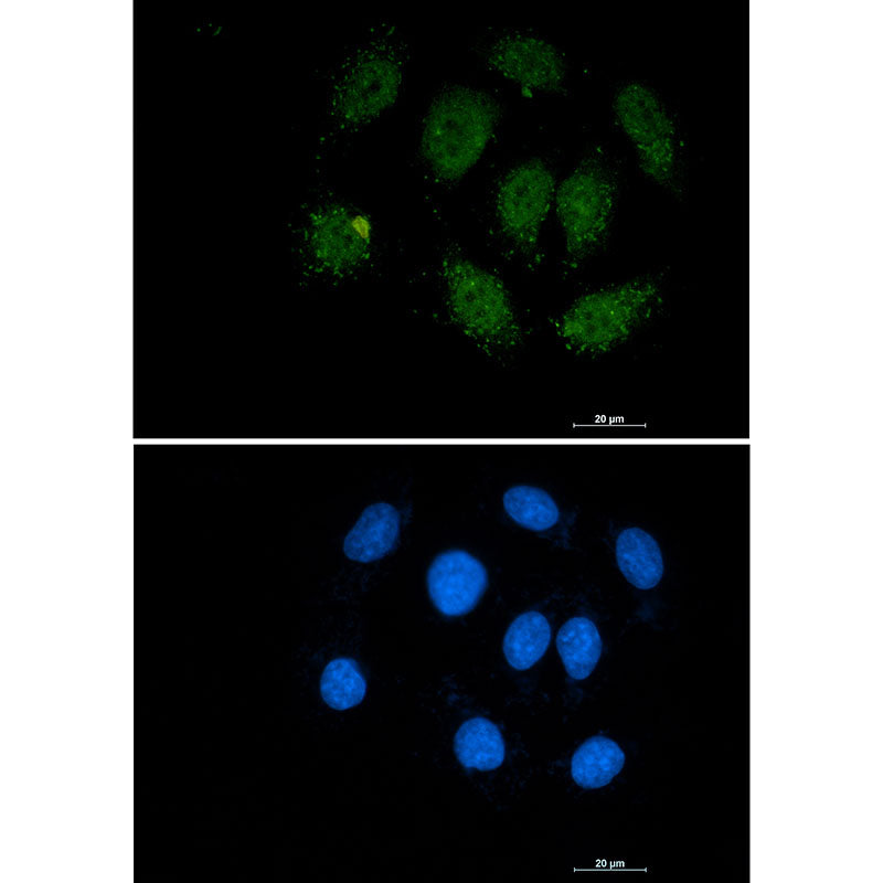Anti-Smad3 Rabbit Monoclonal Antibody