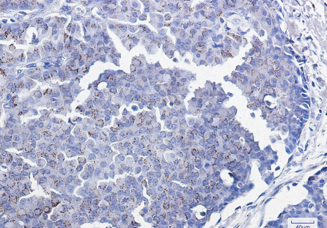 Anti-Smad3 Rabbit Monoclonal Antibody