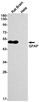 Anti-GFAP Rabbit Monoclonal Antibody