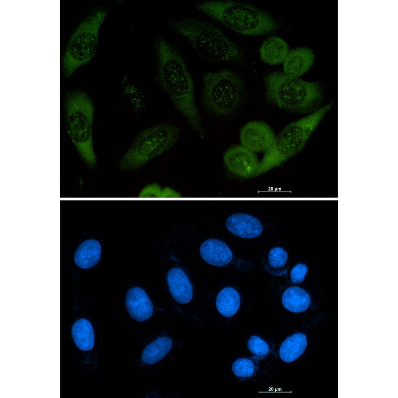 Anti-Profilin 1 Rabbit Monoclonal Antibody