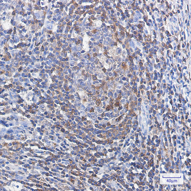 Anti-Profilin 1 Rabbit Monoclonal Antibody