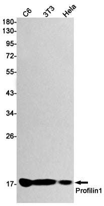 Anti-Profilin 1 Rabbit Monoclonal Antibody