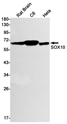 Anti-SOX10 Rabbit Monoclonal Antibody