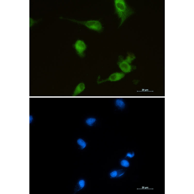 Anti-Heme Oxygenase 1 Rabbit Monoclonal Antibody