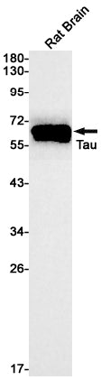 Anti-Tau Rabbit Monoclonal Antibody