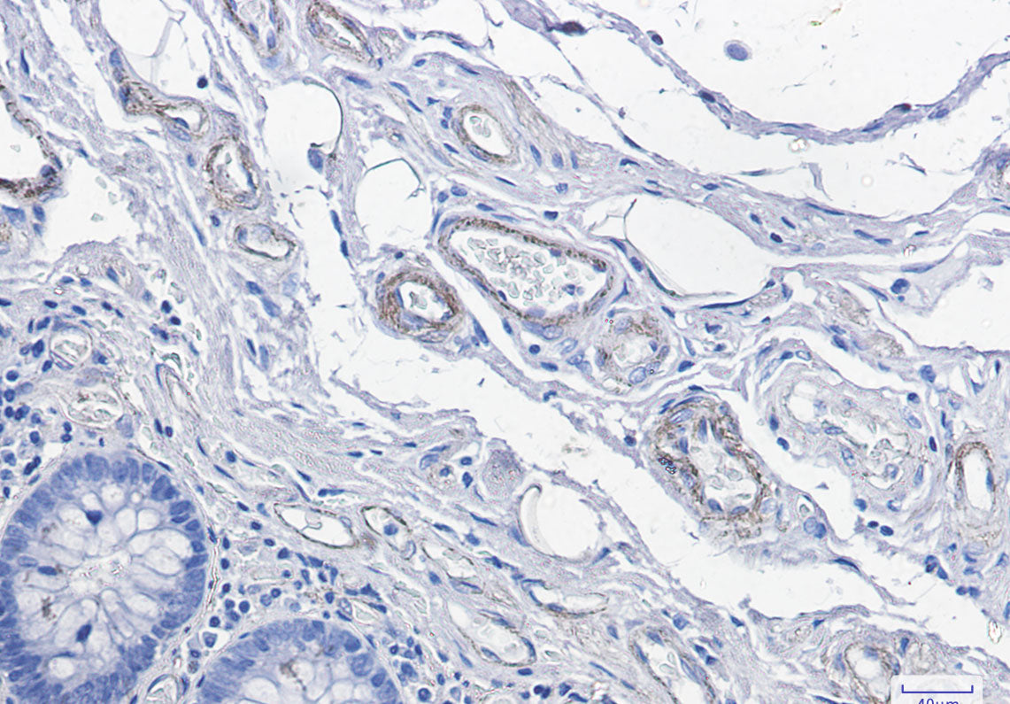 Anti-CD146 Rabbit Monoclonal Antibody