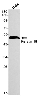 Anti-Cytokeratin 18 Rabbit Monoclonal Antibody
