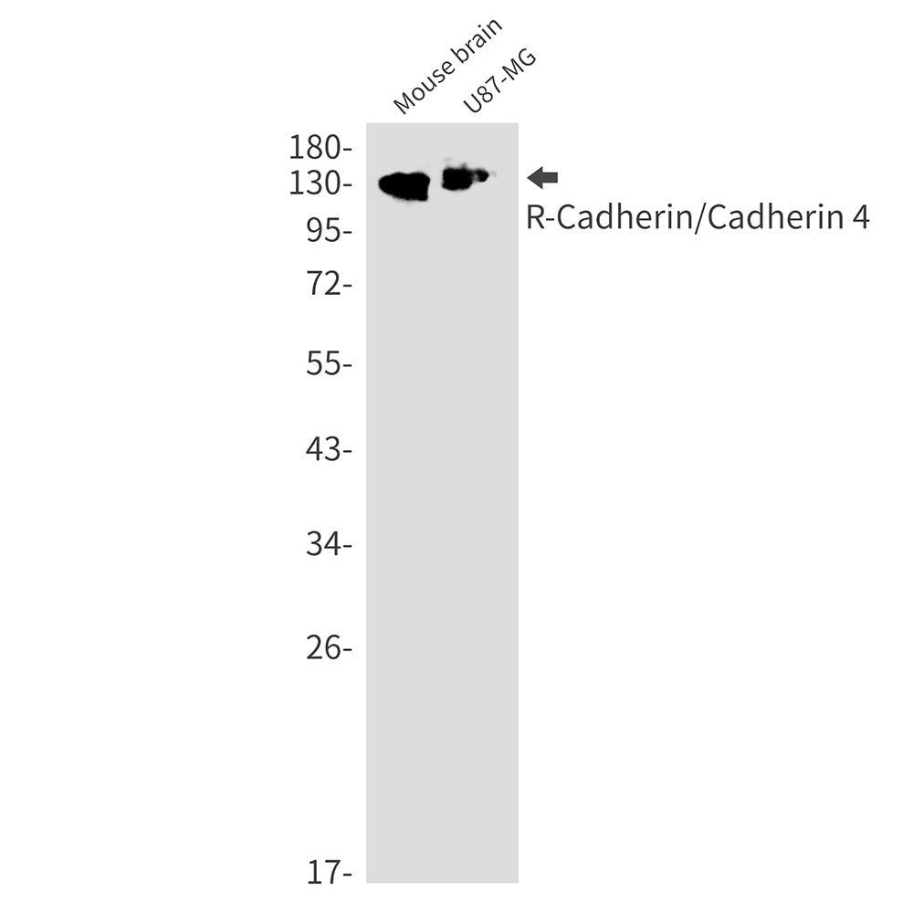 Anti-R Cadherin Rabbit Monoclonal Antibody