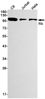 Anti-Rb Rabbit Monoclonal Antibody
