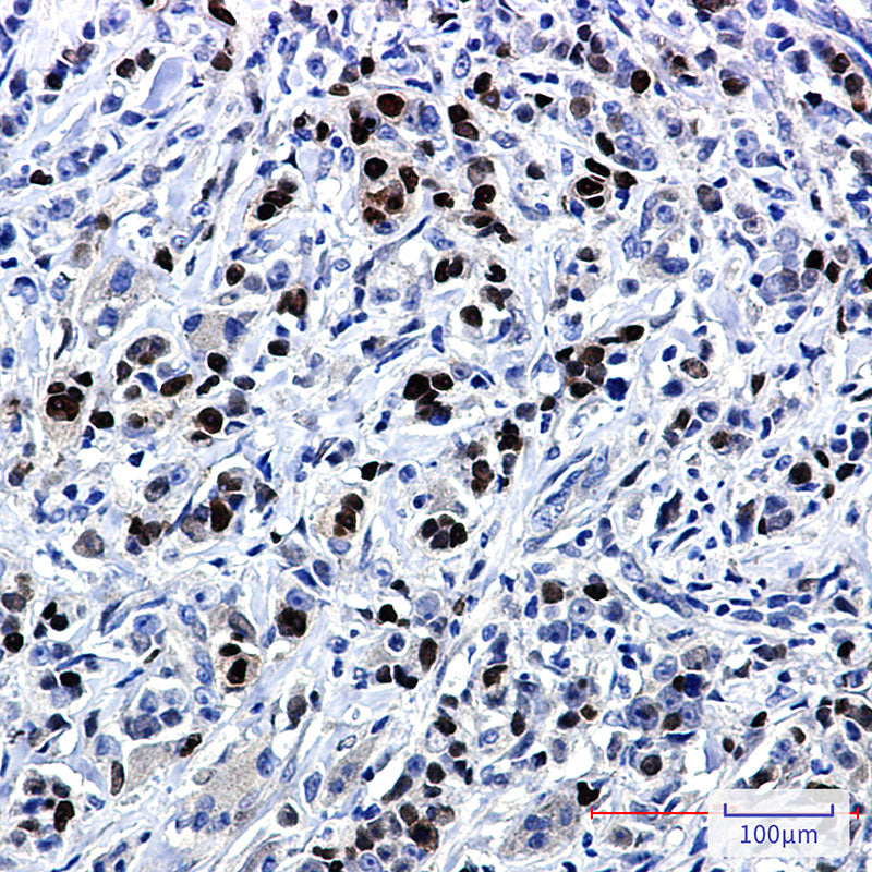 Anti-SOX9 Rabbit Monoclonal Antibody