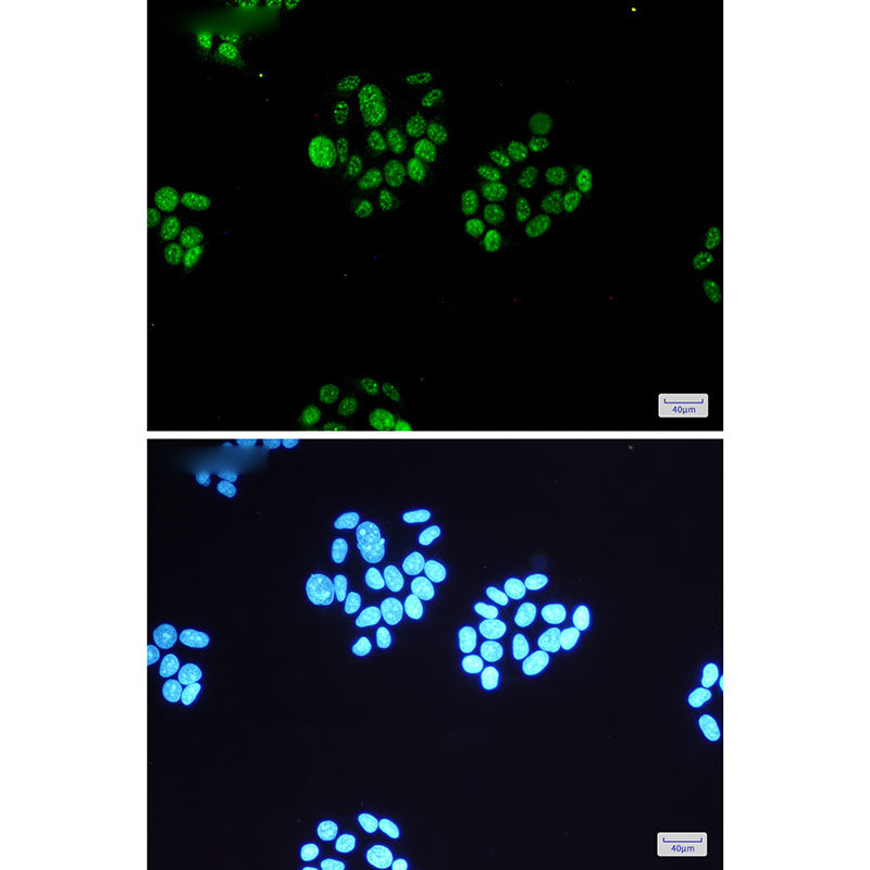 Anti-Phospho-MSK1 (Ser360) Rabbit Monoclonal Antibody