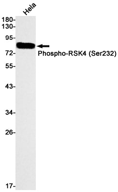 Anti-Phospho-RSK4 (Ser232) Rabbit Monoclonal Antibody