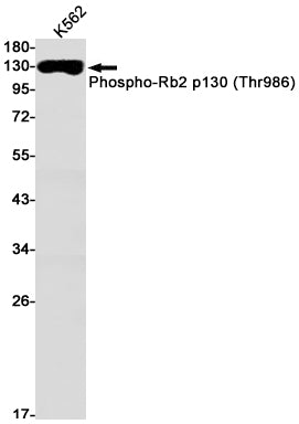 Anti-Phospho-Rb2 p130 (Thr986) Rabbit Monoclonal Antibody